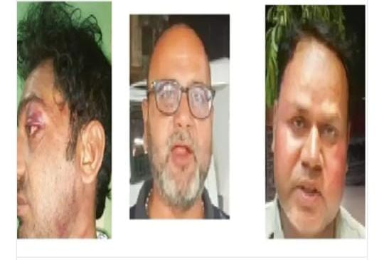 मानवता बचाने आए पत्रकार पर पुलिस की बर्बरता: मारपीट, धमकी और जबरन बयान की शिकायत